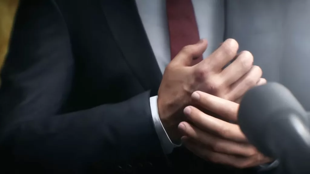 Presidente dos EUA se preparando para declaração sentindo dor na mão que está roxa.