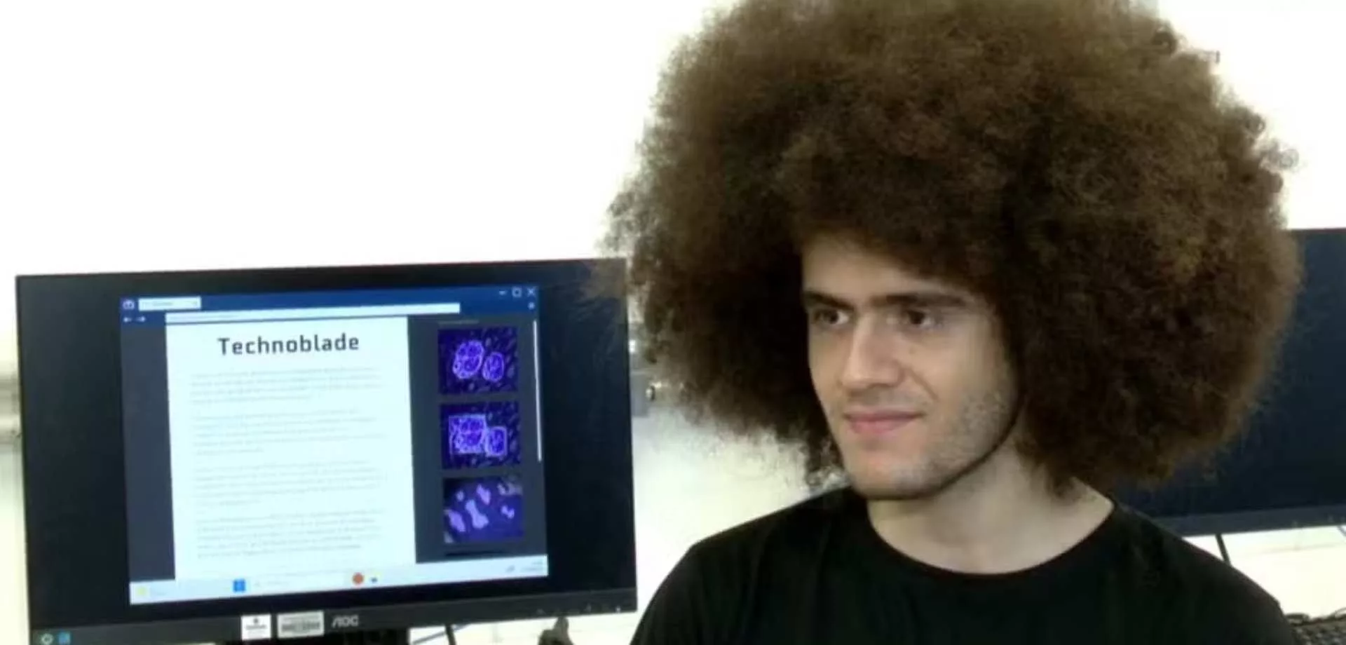 Estudante brasileiro desenvolve projeto que ajuda a identificar doenças